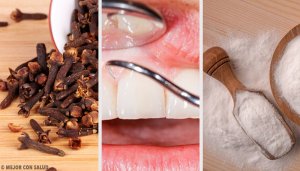Effective Natural Remedies for Gum Disease