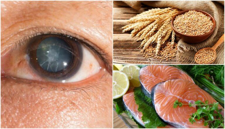 Reduce the Risk of Cataracts by Eating These 7 Foods
