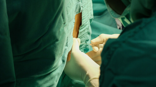 Diagnose Meningitis