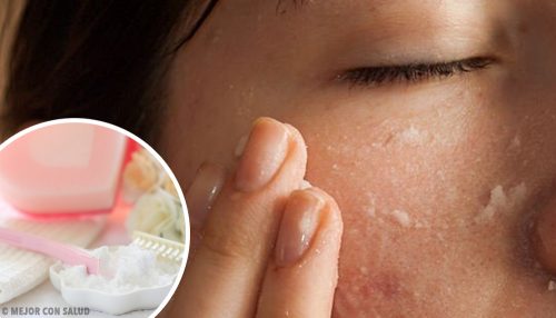 The Best Baking Soda Face Mask Remedies