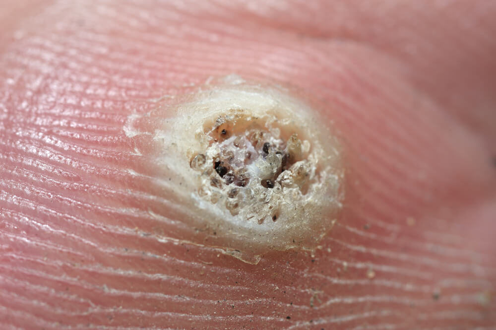 A chicken eye on a finger.