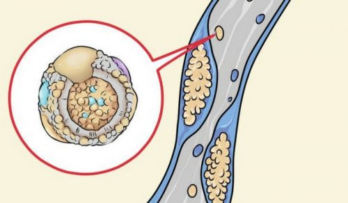 5 Foods to Clean Your Arteries The Natural Way