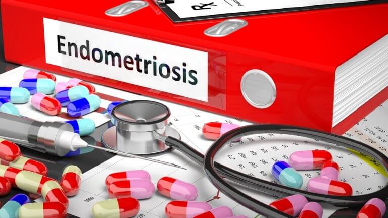 various objects relating to endometriosis