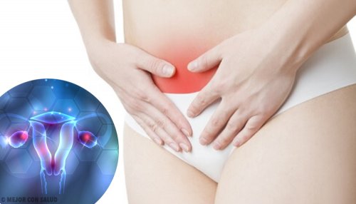 Endometriosis Symptoms & Solutions to Know