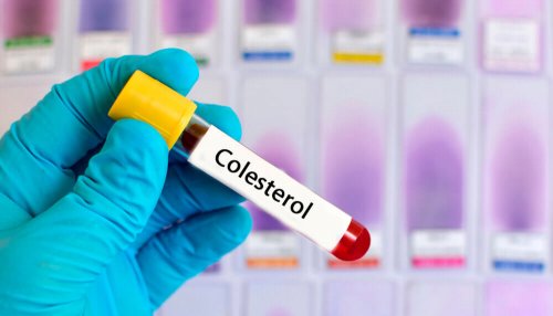 Reduce High Cholesterol with these Six Herbal Remedies