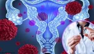 Characteristics of Human Papillomavirus (HPV)