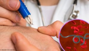 Lyme Disease Symptoms You Need to Know