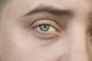 Warning Signs of Liver Toxicity