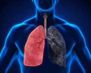 8 Symptoms of Pneumonia that You Shouldn't Ignore