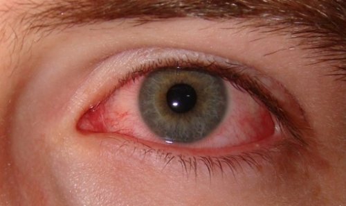red eye