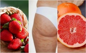 6 Fruits You Can Eat to Reduce Cellulite Easily
