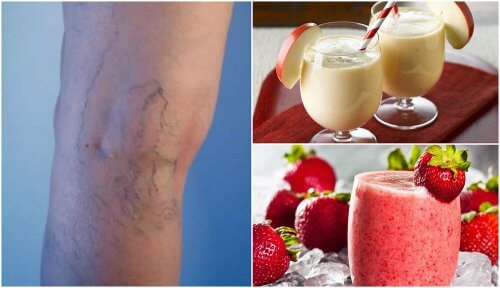 Smoothies To Reduce The Appearance Of Varicose Veins