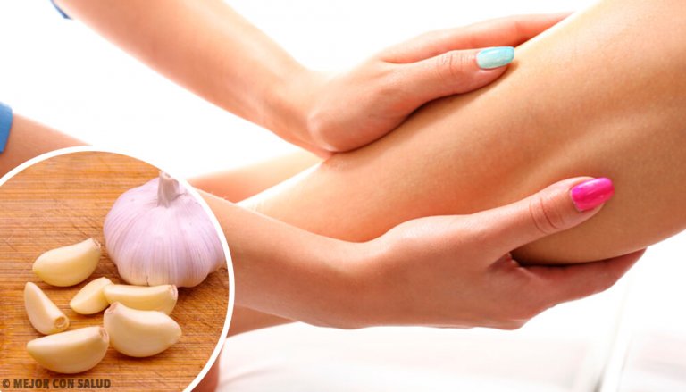 Natural Treatments for Fluid Retention