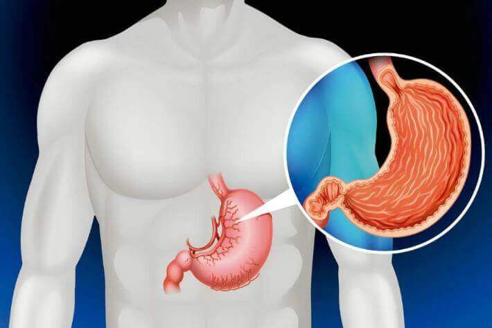 Stomach