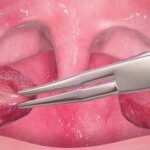 Organs that You Don't Actually Need