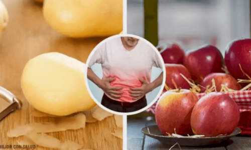 8 Good Foods to Reduce Stomach Ulcers