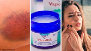 11 Surprising Uses for the Famous Vicks VapoRub