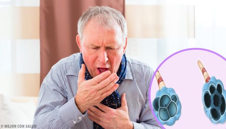 Chronic Obstructive Pulmonary Ddisease (COPD)