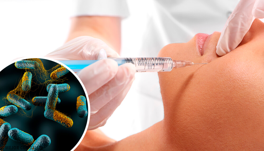 Botulinum Toxin, a Lethal Poison