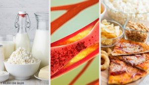 Foods that Clog Your Arteries