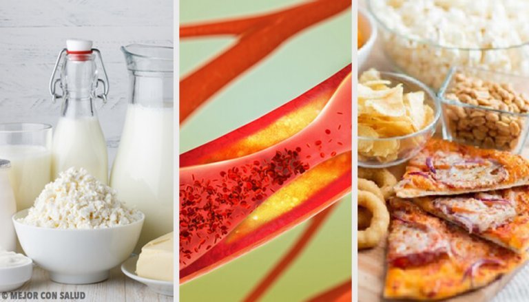 Foods that Clog Your Arteries