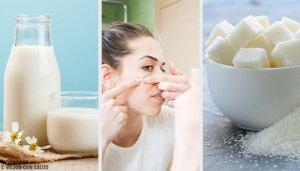 Eliminate Skin Impurities with These Four Masks