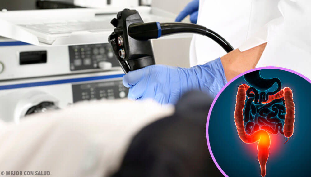 Everything You Need to Know About Treating Colon Cancer Everything You Need to Know About Treating Colon Cancer