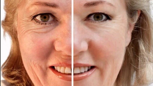 Rimpels verdwijnen bij het eten van pruimen