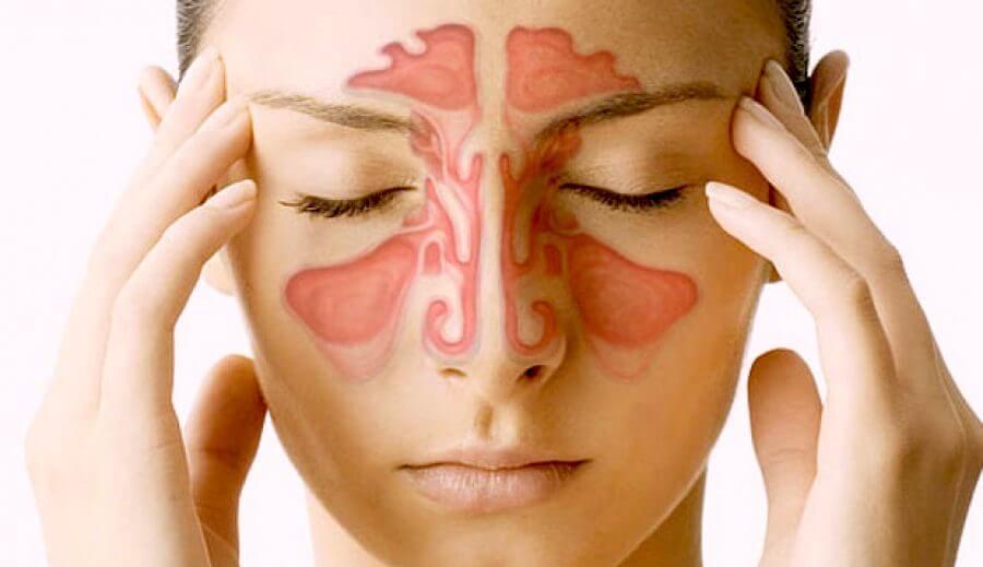 Paranasal Sinuses: 5 Things You Should Know