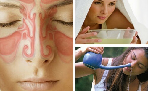 Ways to treat a sinus infection.