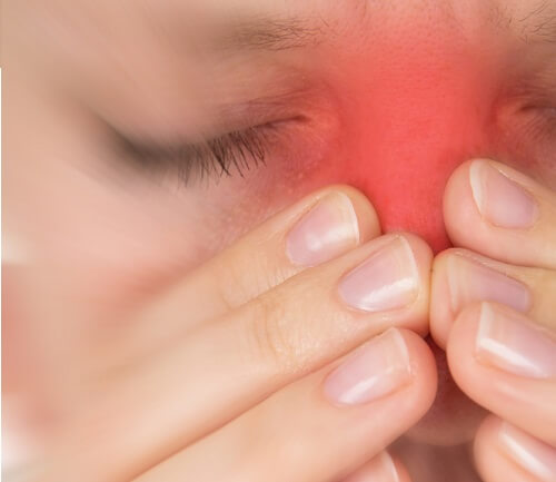 A woman suffering from sinus problems.