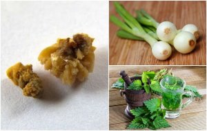Fight Uric Acid Crystals with These Natural Remedies