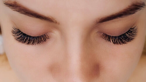 A woman with eyelashes falling out.