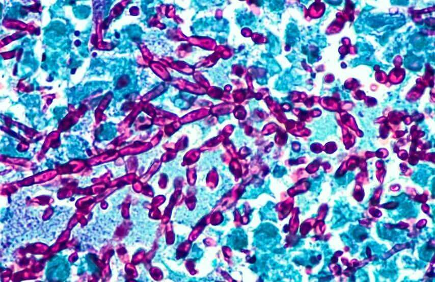 Some bacteria which are causes of vaginal infections.