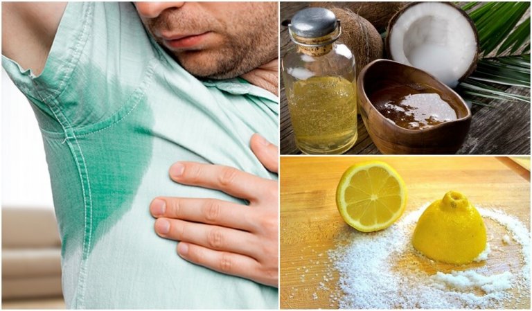 Treat Excessive Sweating with 5 Natural Remedies