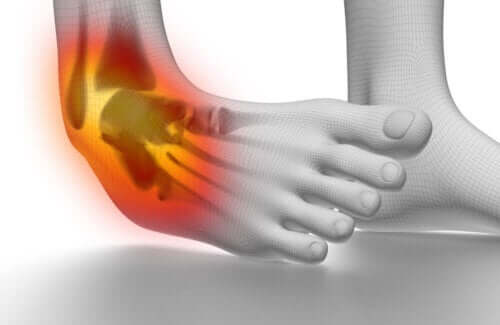 6 Tips To Prevent And Treat Ankle Sprains