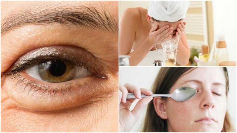 6 Natural Methods to Reduce Under Eye Bags