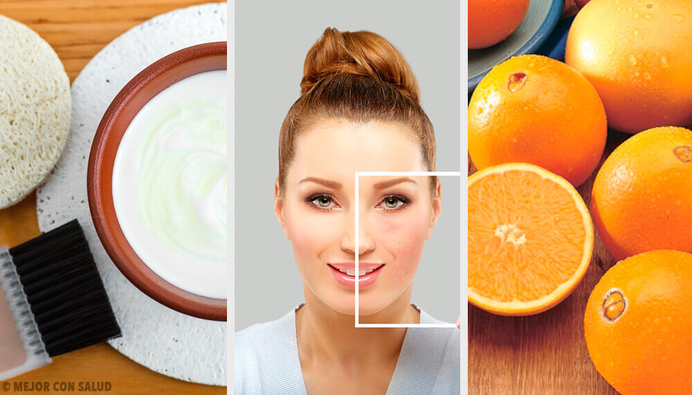 Incredible Natural Ways to Get Rid of Skin Blemishes Incredible Natural Ways to Get Rid of Skin Blemishes