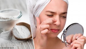 Four Baking Soda Masks for Removing Blackheads