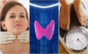 How do You Know if You Have Hypothyroidism? Discover 10 Symptoms of Hypothyroidism