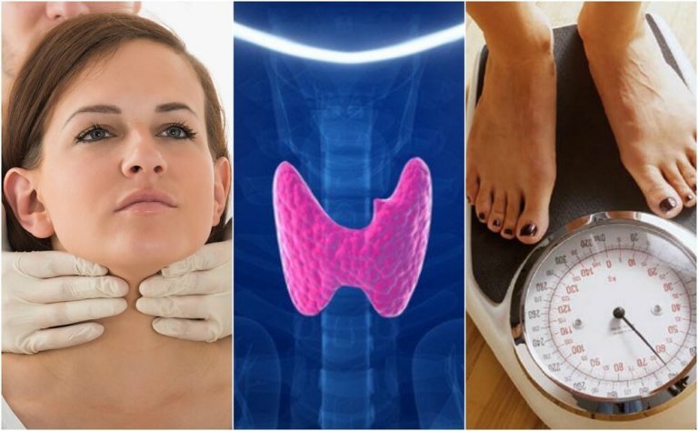 How do You Know if You Have Hypothyroidism? Discover 10 Symptoms of Hypothyroidism