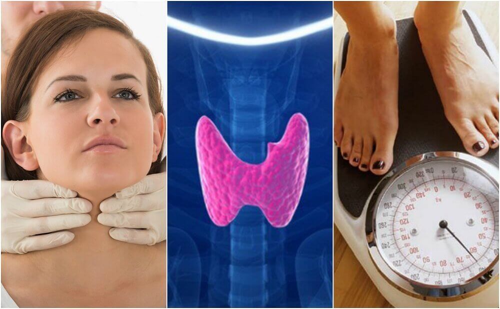 How do You Know if You Have Hypothyroidism? Discover 10 Symptoms of Hypothyroidism