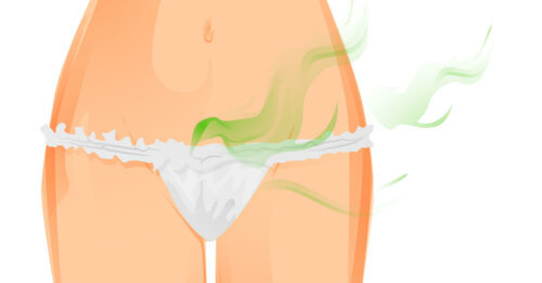 A woman with vaginal odors.