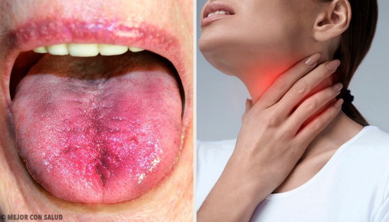 Tonsil stones - six ways to know if you have them