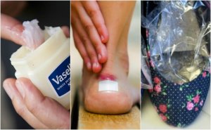 Seven Tips to Prevent Your Shoes from Giving You Blisters