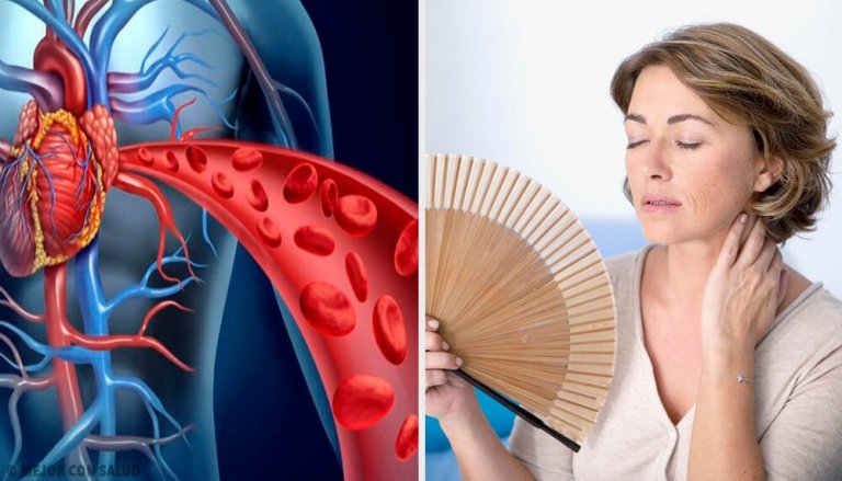 How Menopause Affects Heart Health