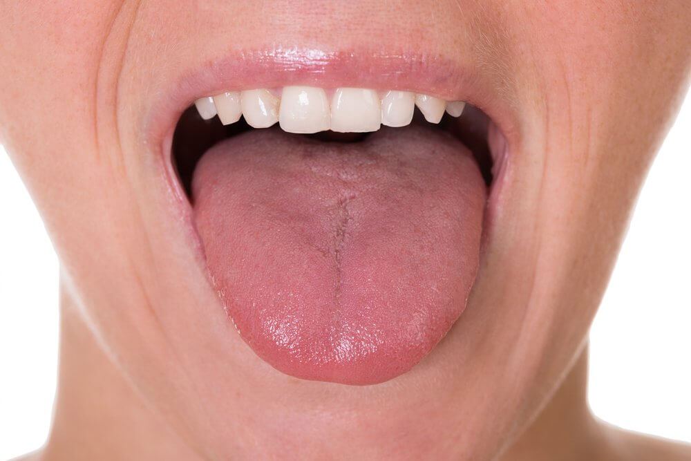 Check Your Tongue
