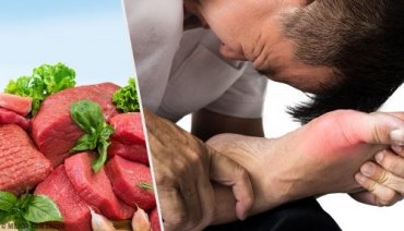 High Uric Acid: 5 Common Causes