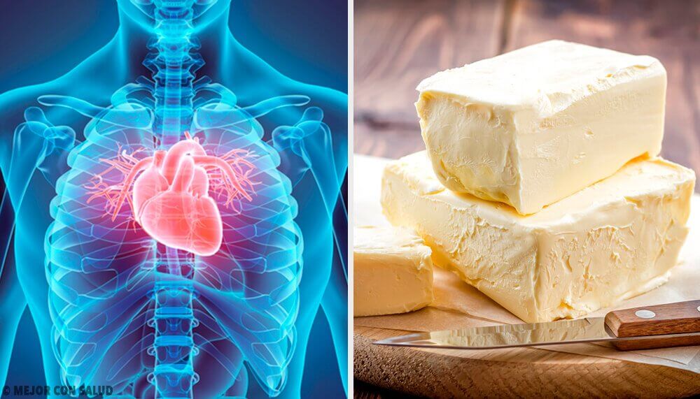 5 Foods that Seriously Hurt Your Heart
