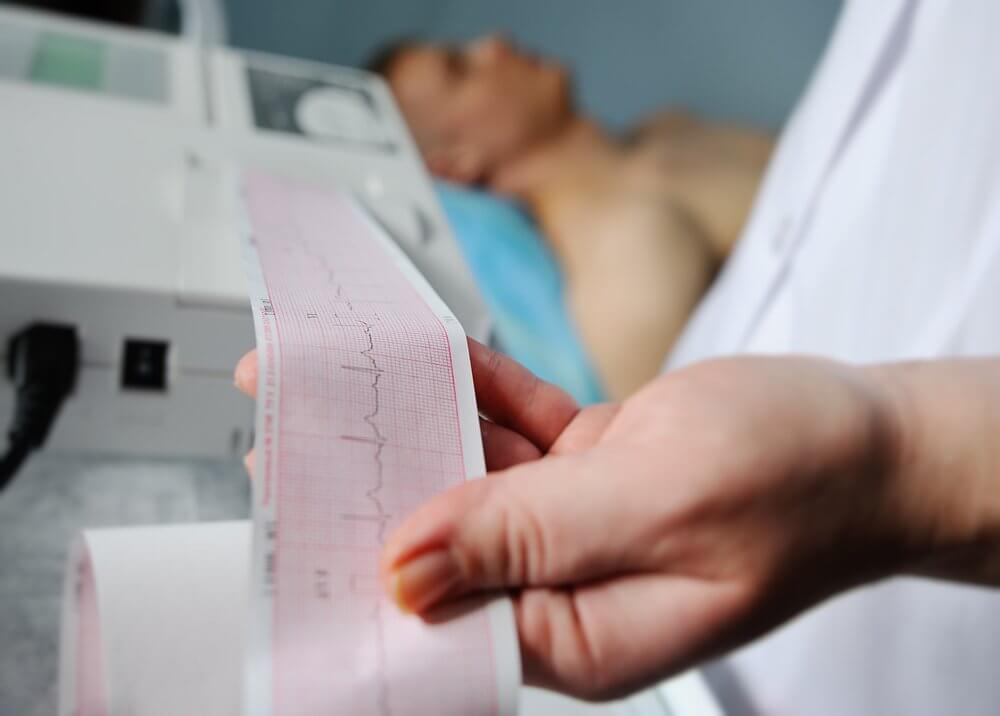 doctor holding EKG results